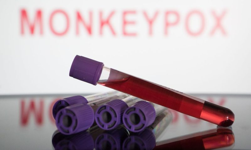 SP lança Rede Emílio Ribas de Combate à Monkeypox